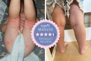 Revue DermaGen : photos avant et après peau de bébé