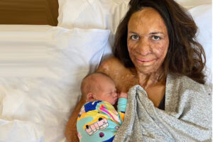 Turia Pitt accueille son deuxième magnifique petit garçon