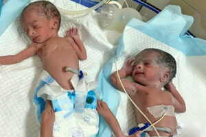 Une femme de 74 ans donne naissance à des jumeaux