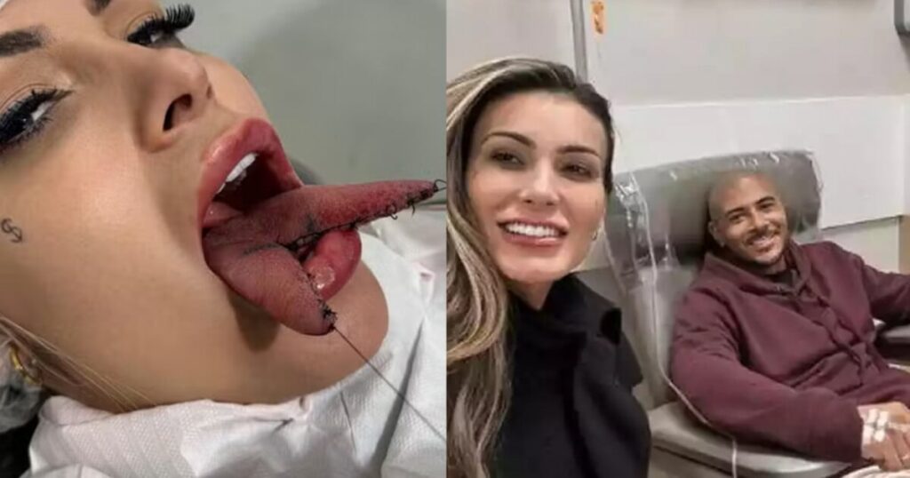 Bon sang ! Après avoir fait ses débuts en Fourchelang, le petit ami d'Andressa Urach se retrouve aux urgences. Découvrez ce qui s'est passé !