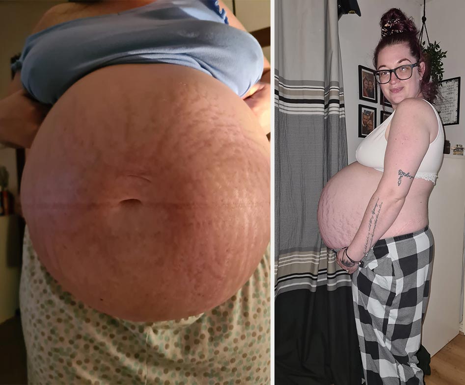 22 photos that show what mums’ baby bumps REALLY look like